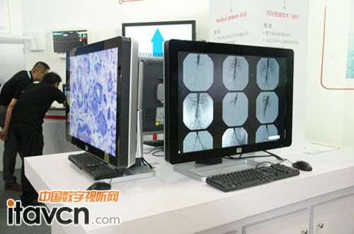 诊断及外科显示屏